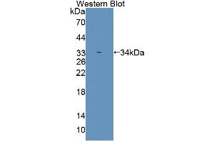 Western blot analysis of the recombinant protein. (SMUG1 anticorps  (AA 1-270))