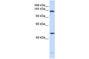 Western Blotting (WB) image for anti-ADAM Metallopeptidase with thrombospondin Type 1 Motif, 18 (ADAMTS18) antibody (ABIN2459683) (ADAMTS18 anticorps)