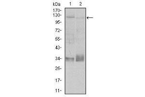 Image no. 2 for anti-Integrin beta 1 (ITGB1) antibody (ABIN1498893) (ITGB1 anticorps)