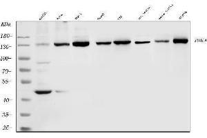 Western blot analysis of HDAC4 using anti-HDAC4 antibody (ABIN5518841).