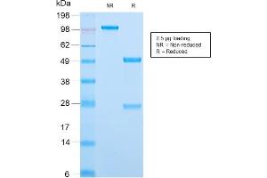 SDS-PAGE Analysis Purified MCM7 Rabbit Recombinant Monoclonal Antibody (MCM7/2832R).