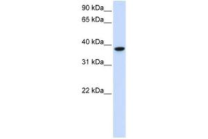 GLT8D2 antibody used at 1 ug/ml to detect target protein. (GLT8D2 anticorps  (C-Term))
