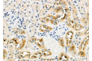 ABIN6262907 and ABIN6276982 at 1/100 staining Rat kidney tissue by IHC-P. (LAMP2 anticorps  (C-Term))