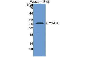 Western blot analysis of the recombinant protein. (RBM38 anticorps  (AA 25-207))