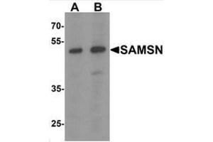 Western blot analysis of SAMSN in Hela cell lysate with SAMSN Antibody  at (A) 0. (SAMSN1 anticorps  (C-Term))