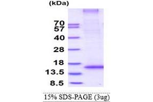 SDS-PAGE (SDS) image for Ring Finger Protein 7 (RNF7) (AA 1-113) protein (His tag) (ABIN5853188)