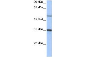 Western Blotting (WB) image for anti-Epoxide Hydrolase 1, Microsomal (Xenobiotic) (EPHX1) antibody (ABIN2459723) (EPHX1 anticorps)