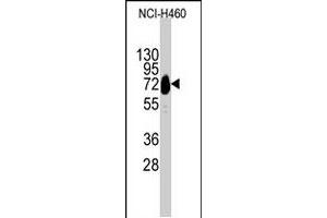 Western blot analysis of CDH10 polyclonal antibody  in NCI-H460 cell line lysates (35 ug/lane).