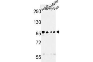 Western Blotting (WB) image for anti-Microtubule Associated serine/threonine Kinase-Like (MASTL) antibody (ABIN3003015) (MASTL anticorps)