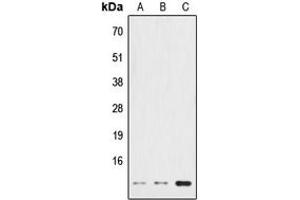 Western blot analysis of HSPE1 expression in HeLa (A), NIH3T3 (B), PC12 (C) whole cell lysates. (HSPE1 anticorps  (Center))