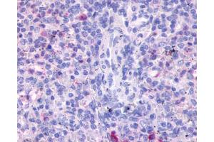 Anti-FPR3 / FPRH2 antibody IHC of human spleen.