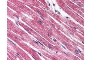 Anti-Endothelin A Receptor antibody IHC of human heart.