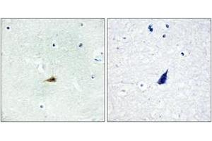 Immunohistochemistry analysis of paraffin-embedded human brain tissue, using NCOR2 Antibody. (NCOR2 anticorps  (AA 511-560))
