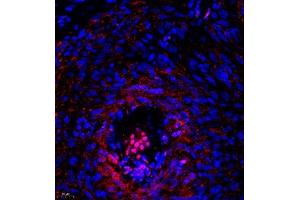Immunofluorescence of paraffin embedded mouse ovary using Thymosin (ABIN7075306) at dilution of 1:1000 (400x lens)
