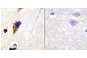 Peptide - +Immunohistochemical analysis of paraffin-embedded human brain tissue using Dynamin-1 (Ab-774) Antibody (#B0422). (Dynamin 1 anticorps  (Ser774))
