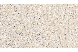 Detection of VEGF165 in Porcine Liver Tissue using Monoclonal Antibody to Vascular Endothelial Growth Factor 165 (VEGF165) (VEGF 165 (AA 28-191) anticorps)