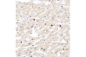 Immunohistochemistry of paraffin embedded rat heart using Bora (ABIN7075236) at dilution of 1:200 (400x lens) (BORA anticorps)