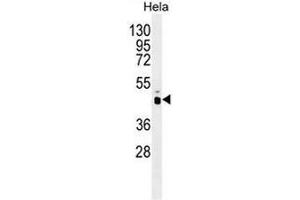 PRKAG1 Antibody (N-term) western blot analysis in Hela cell line lysates (35µg/lane). (PRKAG1 anticorps  (N-Term))