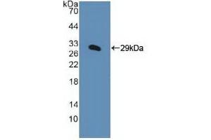 Detection of Recombinant KPNa1, Human using Polyclonal Antibody to Karyopherin Alpha 1 (KPNa1) (KPNA1 anticorps  (AA 239-506))