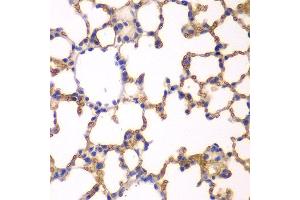 Immunohistochemistry of paraffin-embedded mouse lung using EPB41 antibody at dilution of 1:200 (400x lens). (EPB41 anticorps)