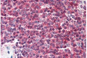 Human Spleen (formalin-fixed, paraffin-embedded) stained with CD27 antibody ABIN396917 at 10 ug/ml followed by biotinylated secondary antibody, alkaline phosphatase-streptavidin and chromogen.