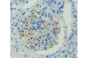 IHC-P analysis of Human Tissue, with DAB staining. (FGF1 anticorps  (AA 1-155))