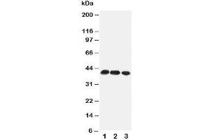 Western blot testing of CCR4 antibody and Lane 1:  mouse thymus;  2: mouse spleen;  3: (m) HEPA cell lysate (CCR4 anticorps  (Middle Region))
