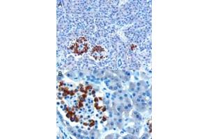 ABIN185408 (10µg/ml) staining of paraffin embedded Human Pancreas. (CCKAR anticorps  (Internal Region))