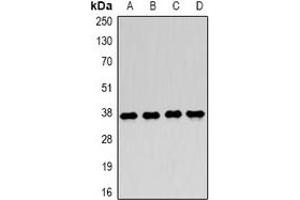 Western blot analysis of LDHA expression in MCF7 (A), Jurkat (B), NIH3T3 (C), mouse skeletal muscle (D) whole cell lysates. (Lactate Dehydrogenase A anticorps)