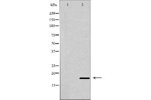 Western blot analysis of extracts of Raji , using BIK antibody. (BIK anticorps  (N-Term))