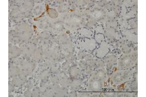 Immunoperoxidase of monoclonal antibody to C3 on formalin-fixed paraffin-embedded human salivary gland.