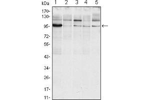 Western blot analysis using ERN1 mouse mAb against Raji (1), A431 (2), Jurkat (3), Hela(4) and HEK293 (5) cell lysate. (ERN1 anticorps)