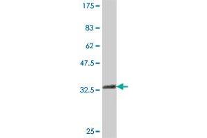 Western Blot detection against Immunogen (37 KDa) . (ELP4 anticorps  (AA 101-199))