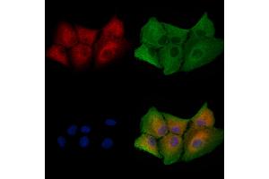 ABIN6258226 and ABIN6273945 staining  cells by IF/ICC. (GRPR anticorps  (Internal Region))