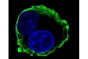 Confocal immunofluorescent analysis of MMP14 antibody with HepG2 cells followed by Alexa Fluor 488-conjugated goat anti-mouse lgG (green).