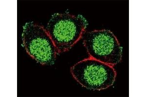 Confocal immunofluorescent analysis of PAX6 antibody with HeLa cells followed by Alexa Fluor 488-conjugated goat anti-rabbit lgG (green).