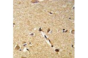 IHC analysis of FFPE human brain tissue stained with DLL3 antibody