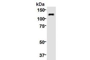 Western Blotting (WB) image for anti-Kinesin Family Member 11 (KIF11) (AA 1-1056), (N-Term) antibody (ABIN1449288) (KIF11 anticorps  (N-Term))