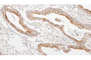 anti-Microtubule-Associated Protein 7 (MAP7) (AA 720-749) antibody