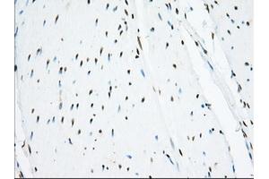 Image no. 1 for anti-Ubiquitin Specific Peptidase 5 (USP5) antibody (ABIN1501693)