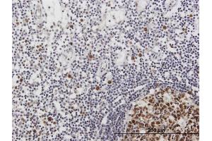 Immunoperoxidase of purified MaxPab antibody to ORC6L on formalin-fixed paraffin-embedded human lymph node.