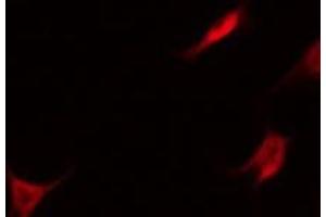 ABIN6275629 staining Hela by IF/ICC.