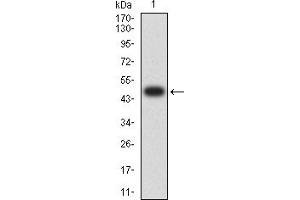 Western blot analysis using KMT2C mAb against human KMT2C (AA: 1-205) recombinant protein. (MLL3 anticorps  (AA 1-205))
