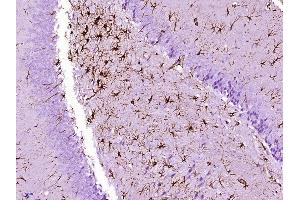 Paraformaldehyde-fixed, paraffin embedded rat brain Antigen retrieval by boiling in sodium citrate buffer (pH6. (GFAP anticorps)