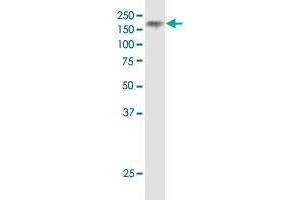 NPC1 monoclonal antibody (M02), clone 4H2.