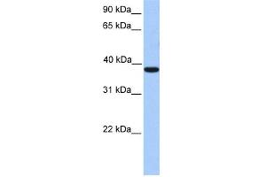 WB Suggested Anti-MEIS1 Antibody Titration:  0. (MEIS1 anticorps  (C-Term))