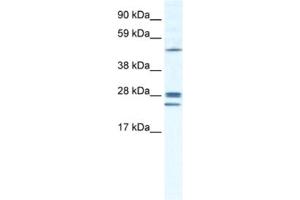 Western Blotting (WB) image for anti-Gap Junction Protein, beta 2, 26kDa (GJB2) antibody (ABIN2461384) (GJB2 anticorps)