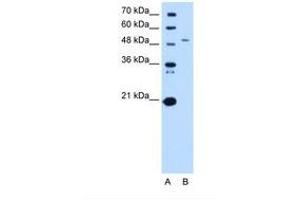 Image no. 2 for anti-serine Palmitoyltransferase, Long Chain Base Subunit 1 (SPTLC1) (AA 254-303) antibody (ABIN6738265) (SPTLC1 anticorps  (AA 254-303))
