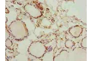 Immunohistochemistry of paraffin-embedded human thyroid tissue using ABIN7154238 at dilution of 1:100 (GLT1D1 anticorps  (AA 17-152))