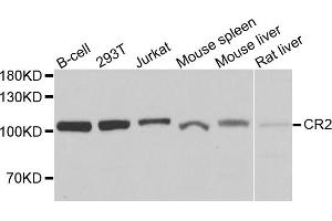 Western blot analysis of extracts of various cell lines, using CR2 antibody. (CD21 anticorps)
